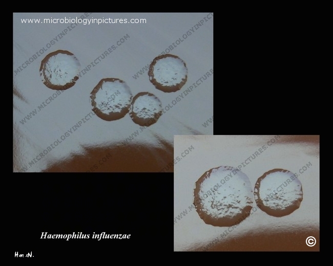 h.influenzae colonies detail